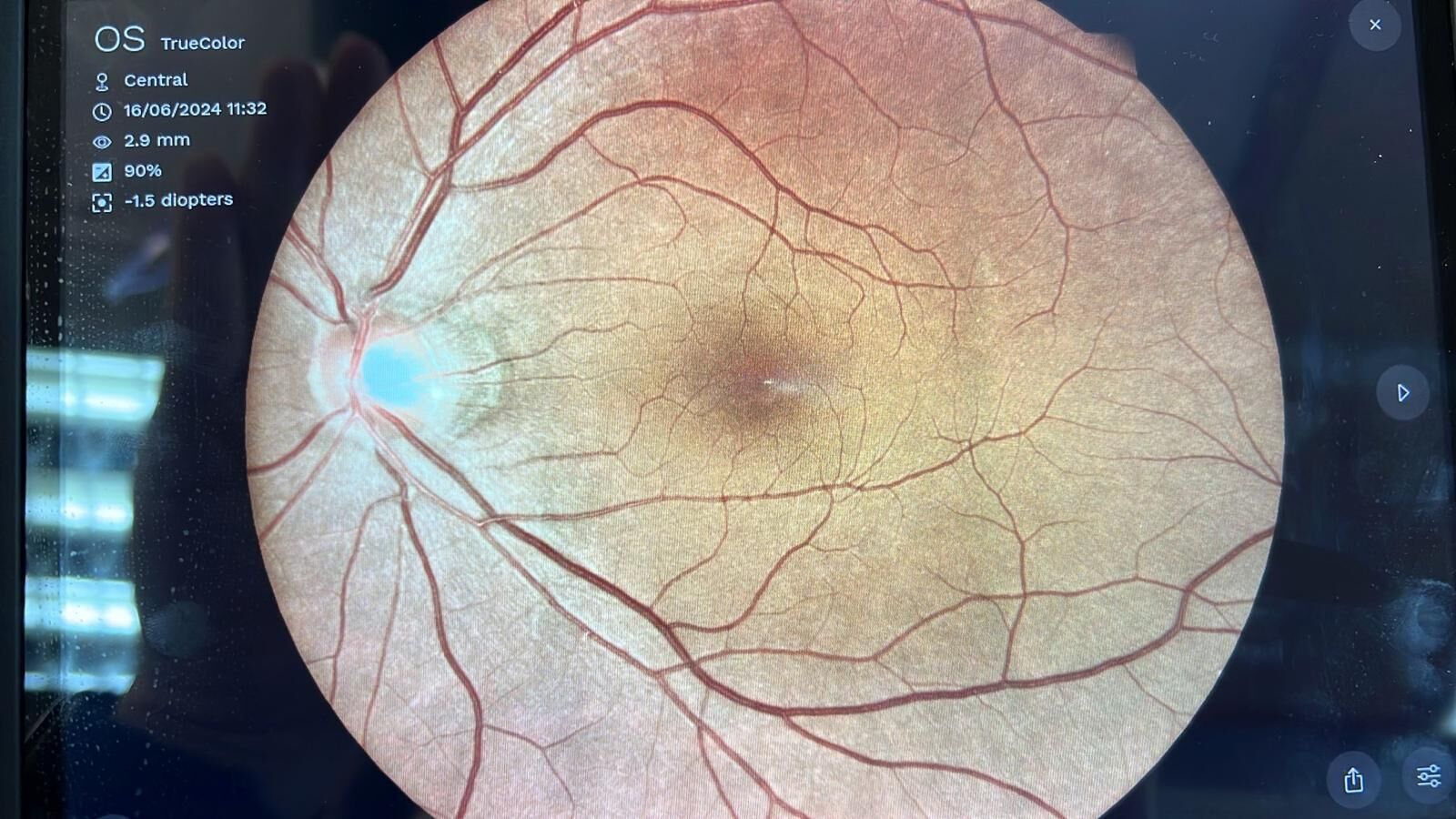 (4531) 驗眼服務1次