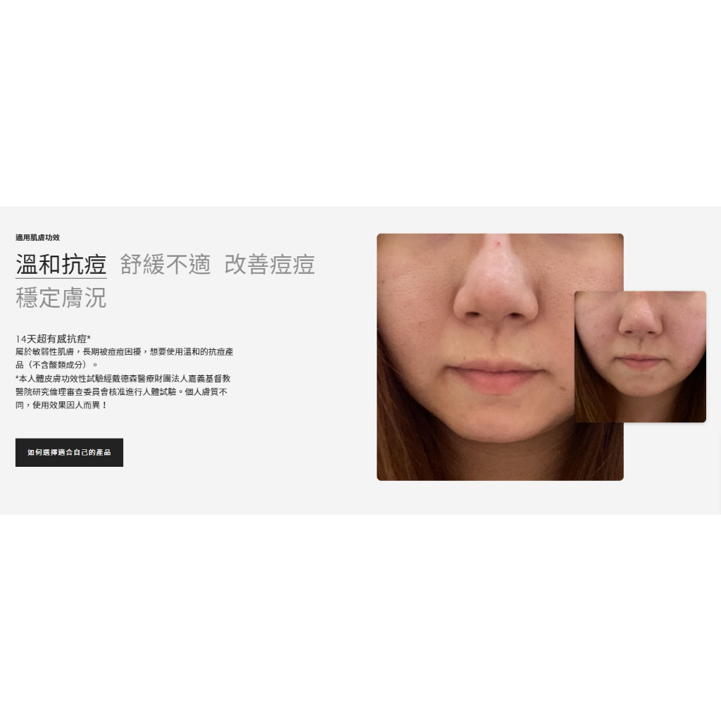 【樂森藥局】🔴近效出清🔴BFFECT 戰痘瓶 Acno 敏感肌抗痘精華30ml