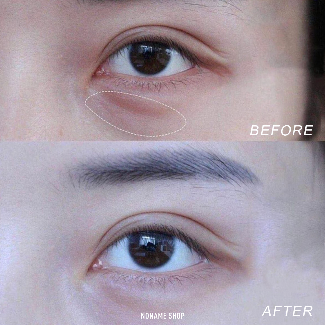 <<現貨供應中!!!>> 日本 Kumargic 去黑眼圈 眼霜 20g 單入