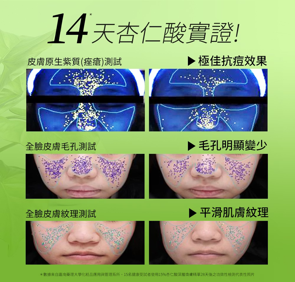 Dr.Hsieh達特醫 15%杏仁酸深層煥膚精華15ml