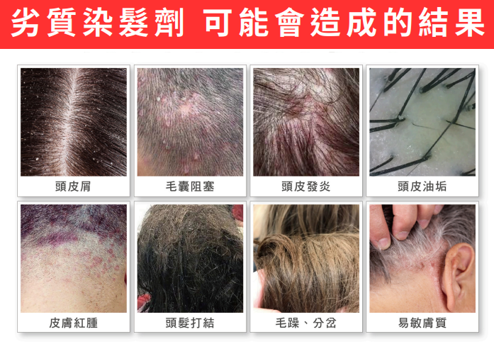 (現貨)M03  MOOI **外泌體** 泡沫染髮320ML   四色選擇👉🏻莫蘭迪亞麻(棕) / 青木黑茶色(黑) / 摩卡慕斯紫(紫) / 暮光莓紅棕(紅) 原價$240  直播價$211  台灣制造