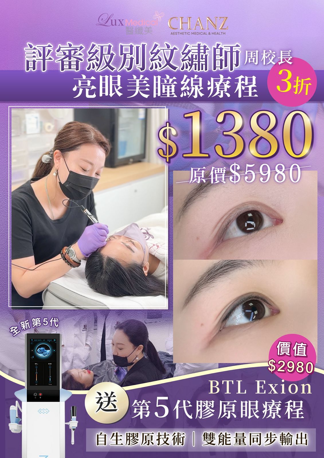 隱形美瞳線（原價$5980）落單即送第5代BTL EXION 膠原眼療程 1次 （價值$2980）