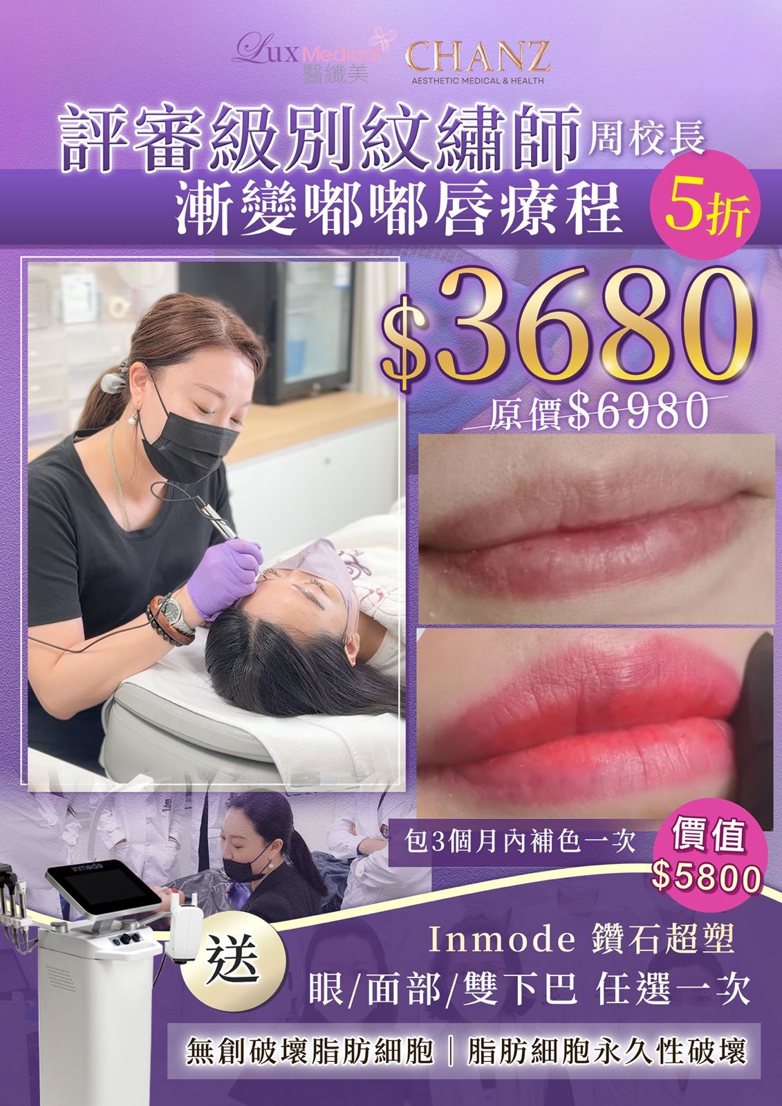 韓式花瓣漸變嘟嘟唇（原價$6980）落單即送以色列INMODE鑽石超塑 眼/面部/雙下巴療程1次 （價值$5800）