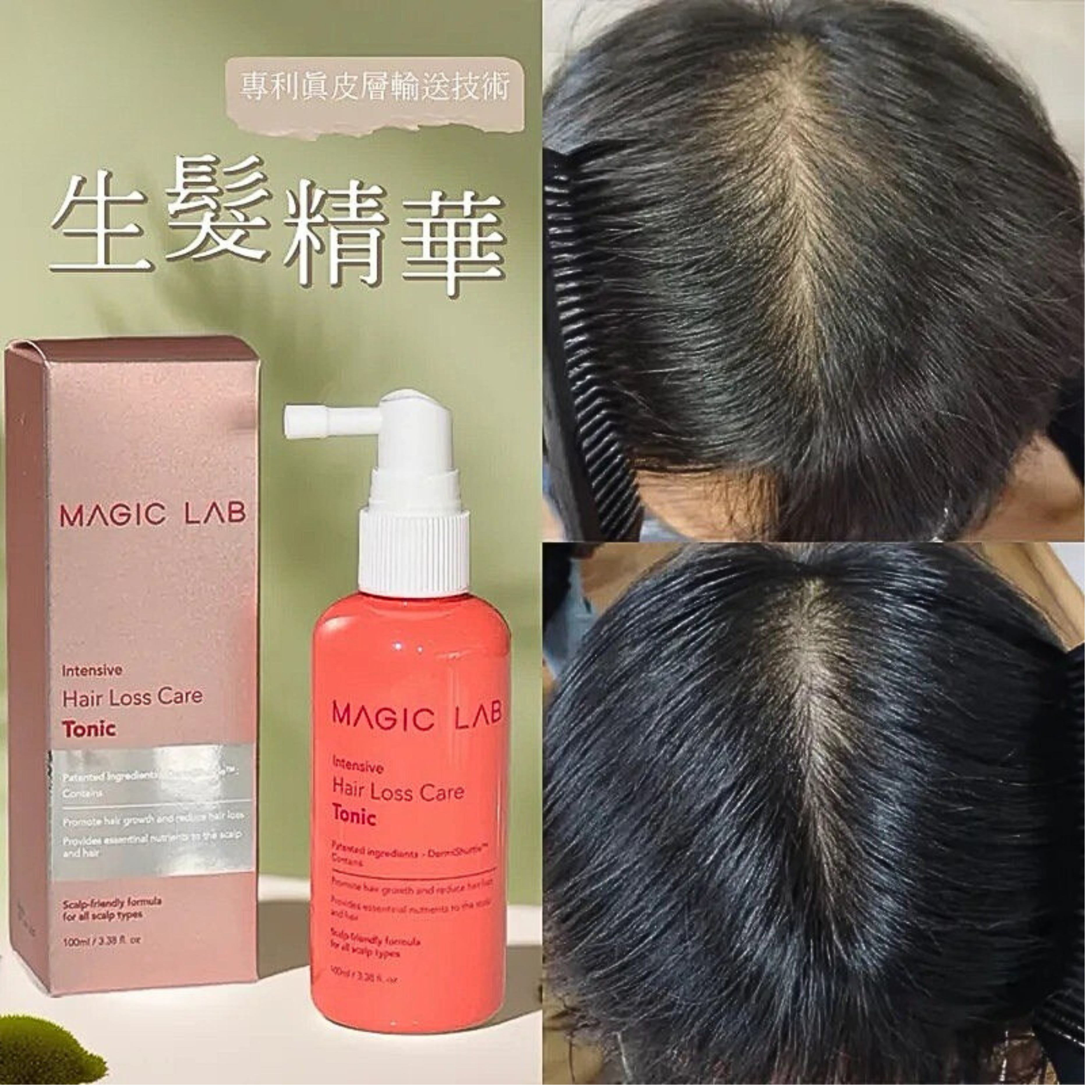 MAGIC LAB 再生防脫頭皮精華 100ml ｜革命性解決脫髮問題
