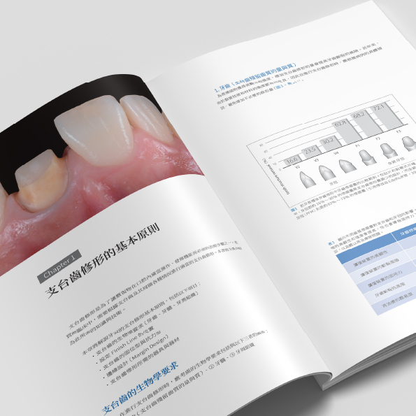 The Tooth Preparation》以提升補綴治療成功率為目標的支台齒修形日