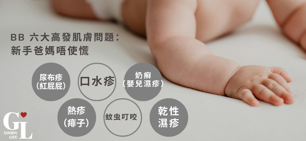 BB6 大高發肌膚問題：新手爸媽唔使慌
