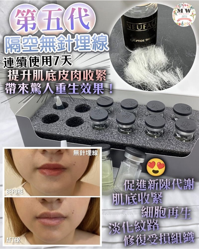 韓國NEUFACE PRO第五代升級版 DERMTHREAD+ 隔空無針埋線 (1套5組）