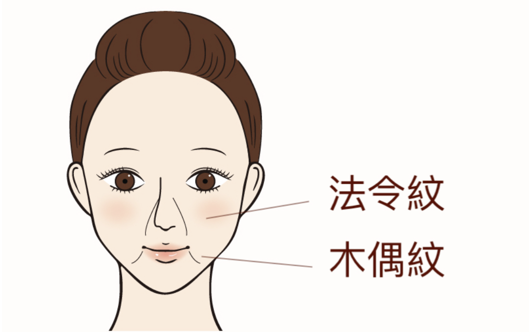 法令紋和木偶紋的位置差異