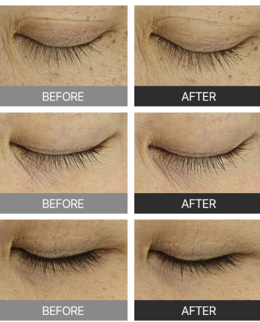 Fromforet 勝肽睫毛增長精華 9ml (透明) -M