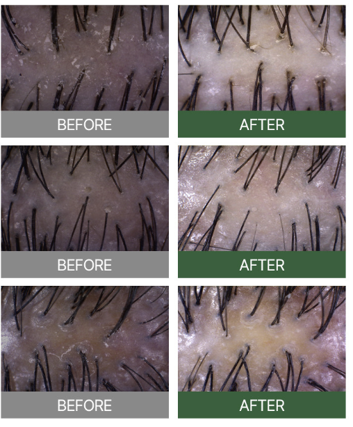 Fromforet 外泌體生髮精華滾珠棒 15ml -M