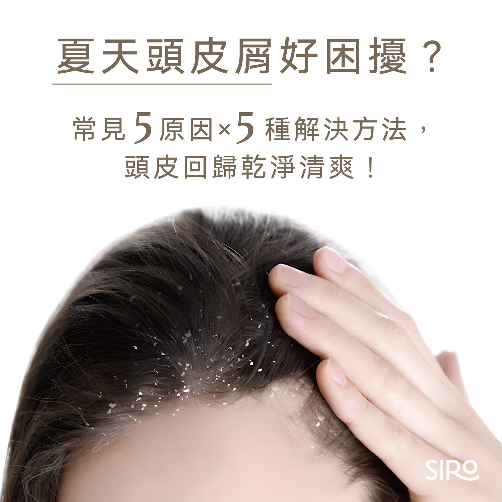 夏天頭皮屑好困擾？常見5原因×5種解決方法，頭皮回歸乾淨清爽