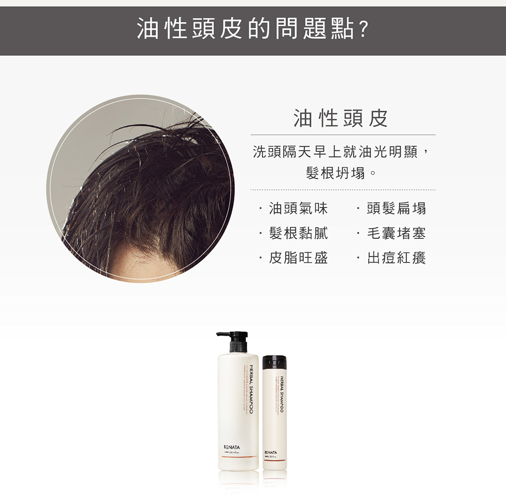 油性頭皮的問題點,洗頭隔天早上就油光明顯,髮根坍塌,油頭氣味,髮根黏膩,皮脂旺盛,頭髮扁塌,毛囊賭塞,出豆紅癢