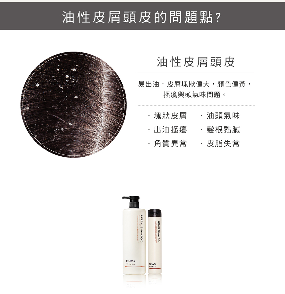 油性皮屑頭皮問題點,油性皮屑頭皮,易出油,皮屑塊狀偏大,顏色偏黃,搔癢與頭氣味問題,塊狀皮屑,出油搔癢,角質異常,油頭氣味,髮根黏膩,皮脂失常