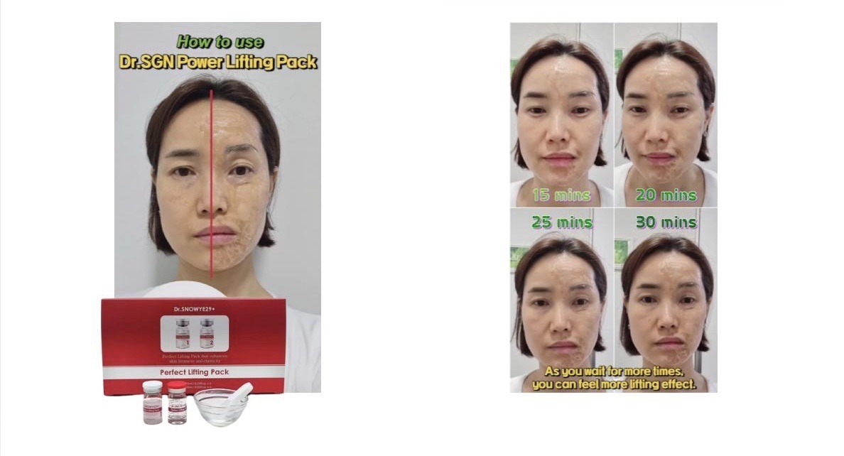 S9 W101409完美提拉女巫面膜（4set)