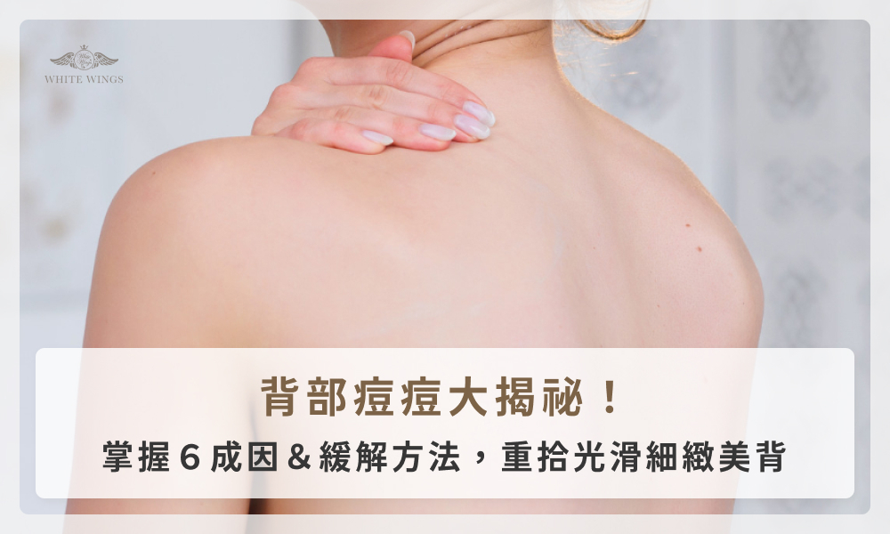 背部痘痘大揭祕!掌握6成因&緩解方法,重拾光滑細緻美背