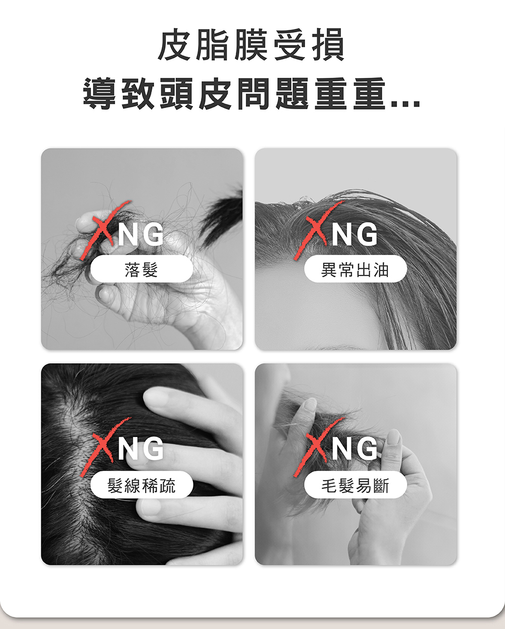 皮脂膜受損,導致頭皮問題重重,落髮,異常出油,髮線稀疏,毛髮易斷