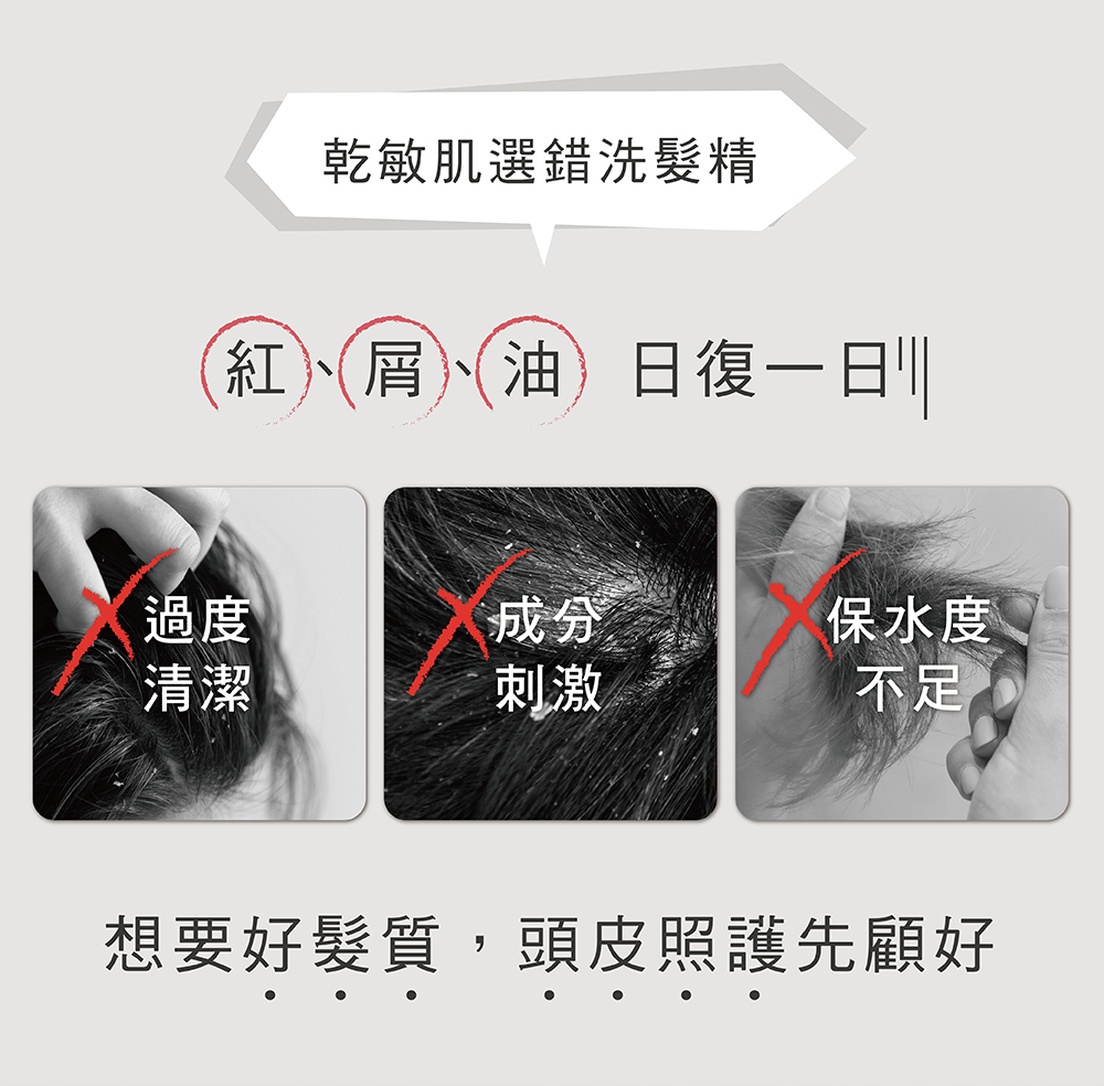 乾敏肌選錯洗髮精,紅屑油,日復一日,過度清潔,成分刺激,保水度不足,想要好髮質,頭皮照護先顧好
