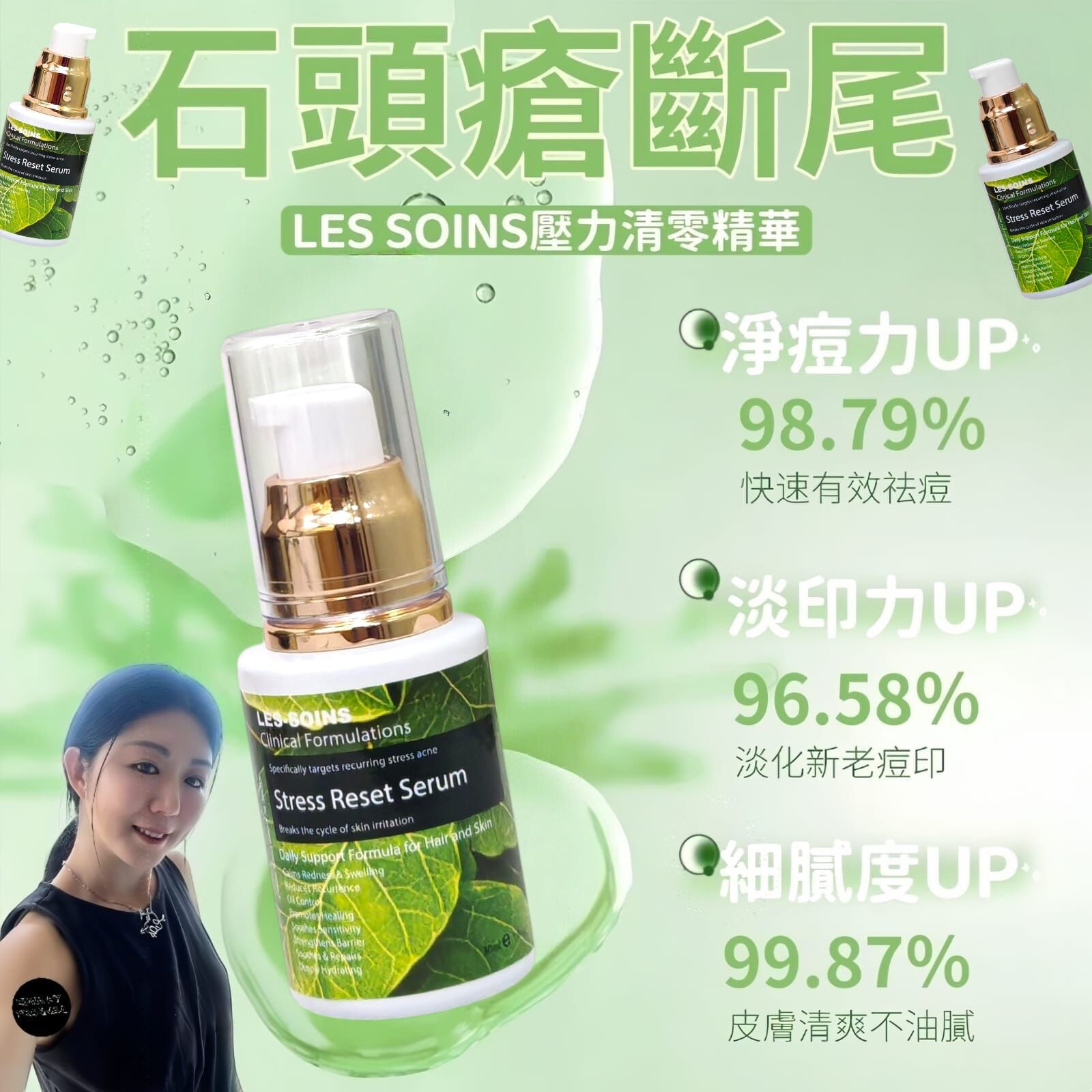 (石頭瘡斷尾 )LES SOINS壓力清零精華Z364 | Stress Reset Serum30ml