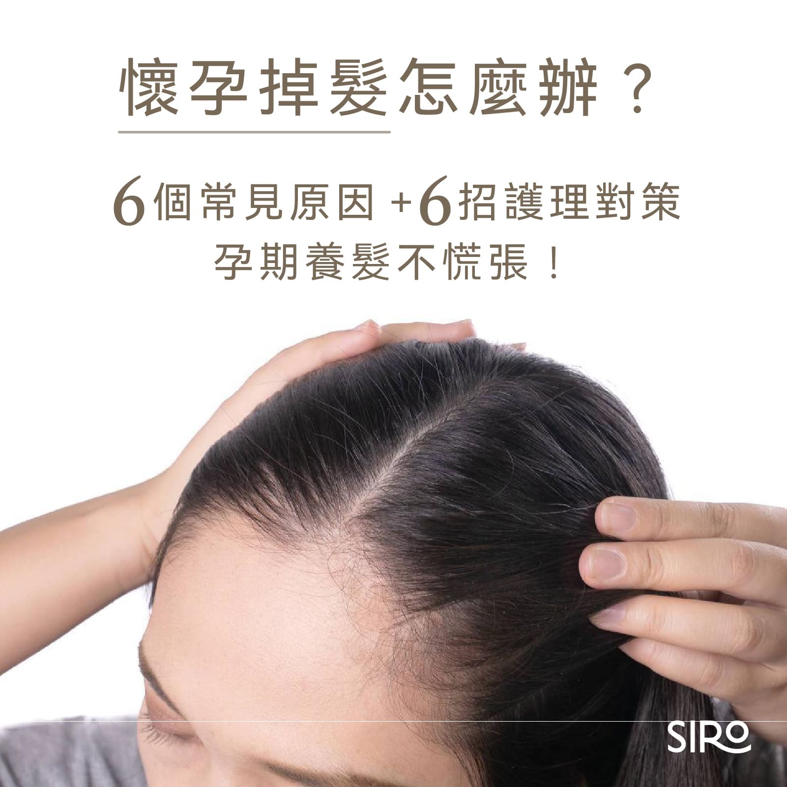 懷孕掉髮怎麼辦?6個常見原因+6招護理對策,孕期養髮不慌張!