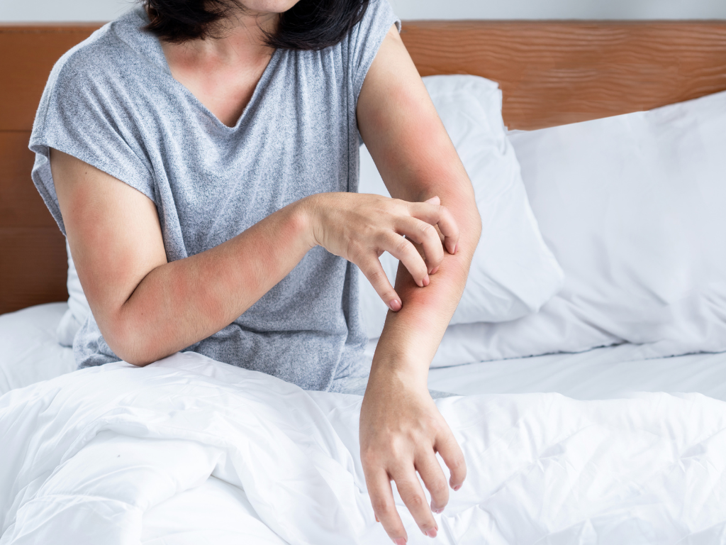 皮膚搔癢過敏床單塵蟎