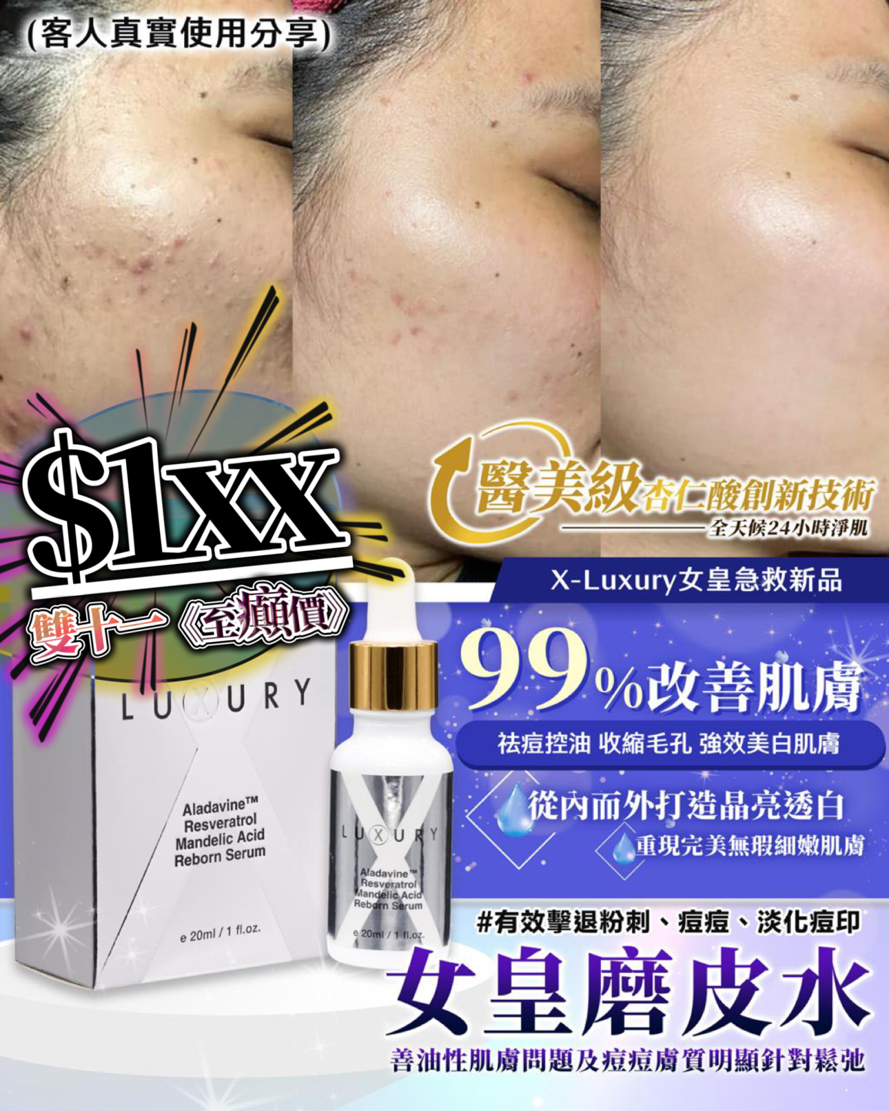 雙十一 超癲價💥女皇磨皮水（到期日:2026年1月)