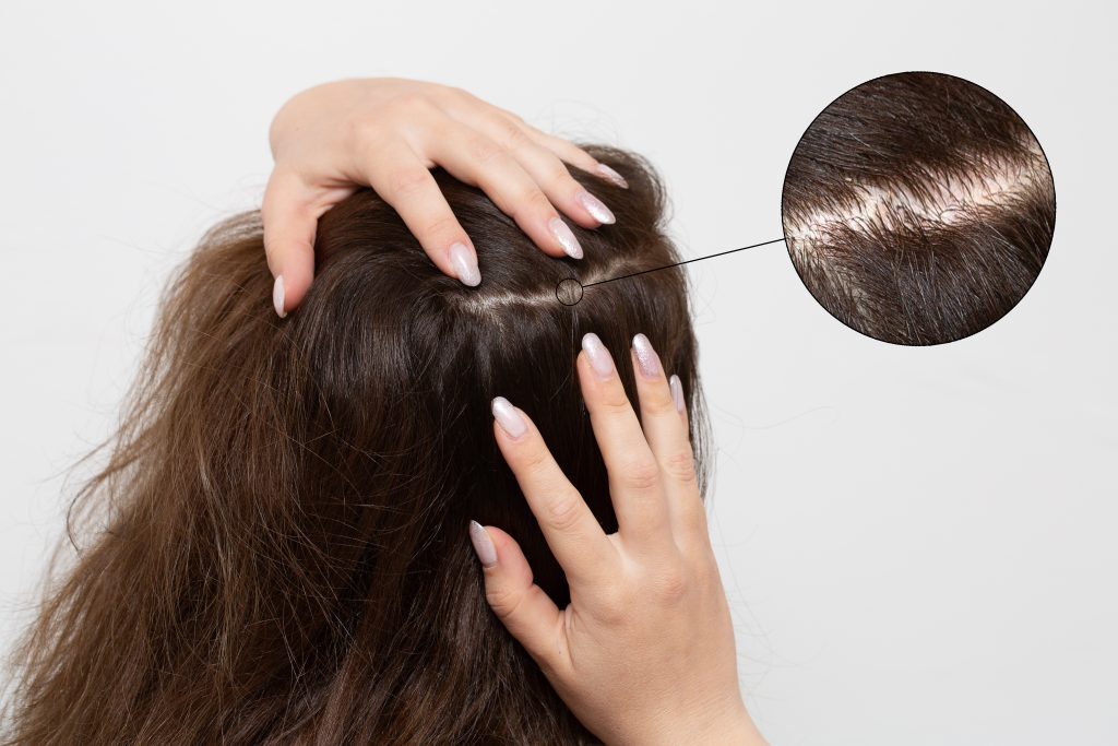 如何讓頭髮變多