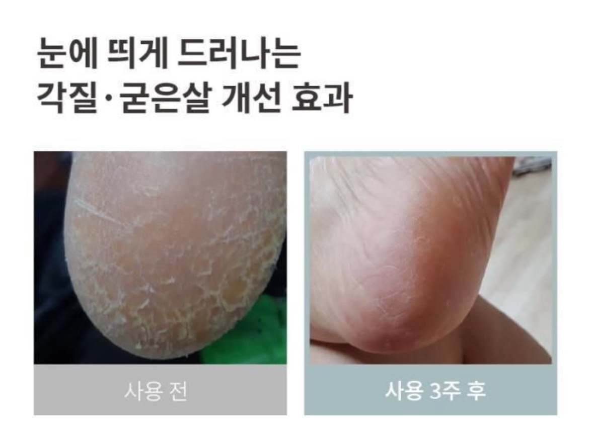 24/10 韓國 hakyung茶樹精油護足滋潤棒