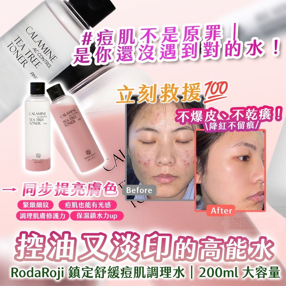 韓國製造 RodaRoji 鎮定舒緩痘肌調理水大容量200ml