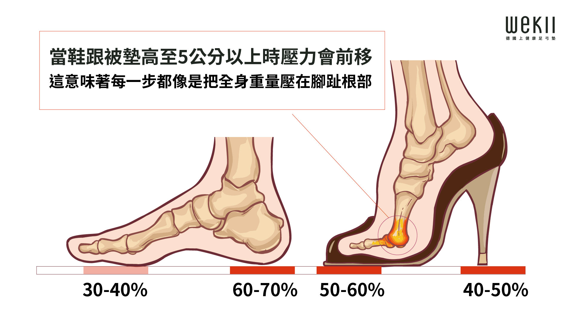 高跟鞋對足弓與前腳掌的受力示意,壓力由後跟前移至前掌
