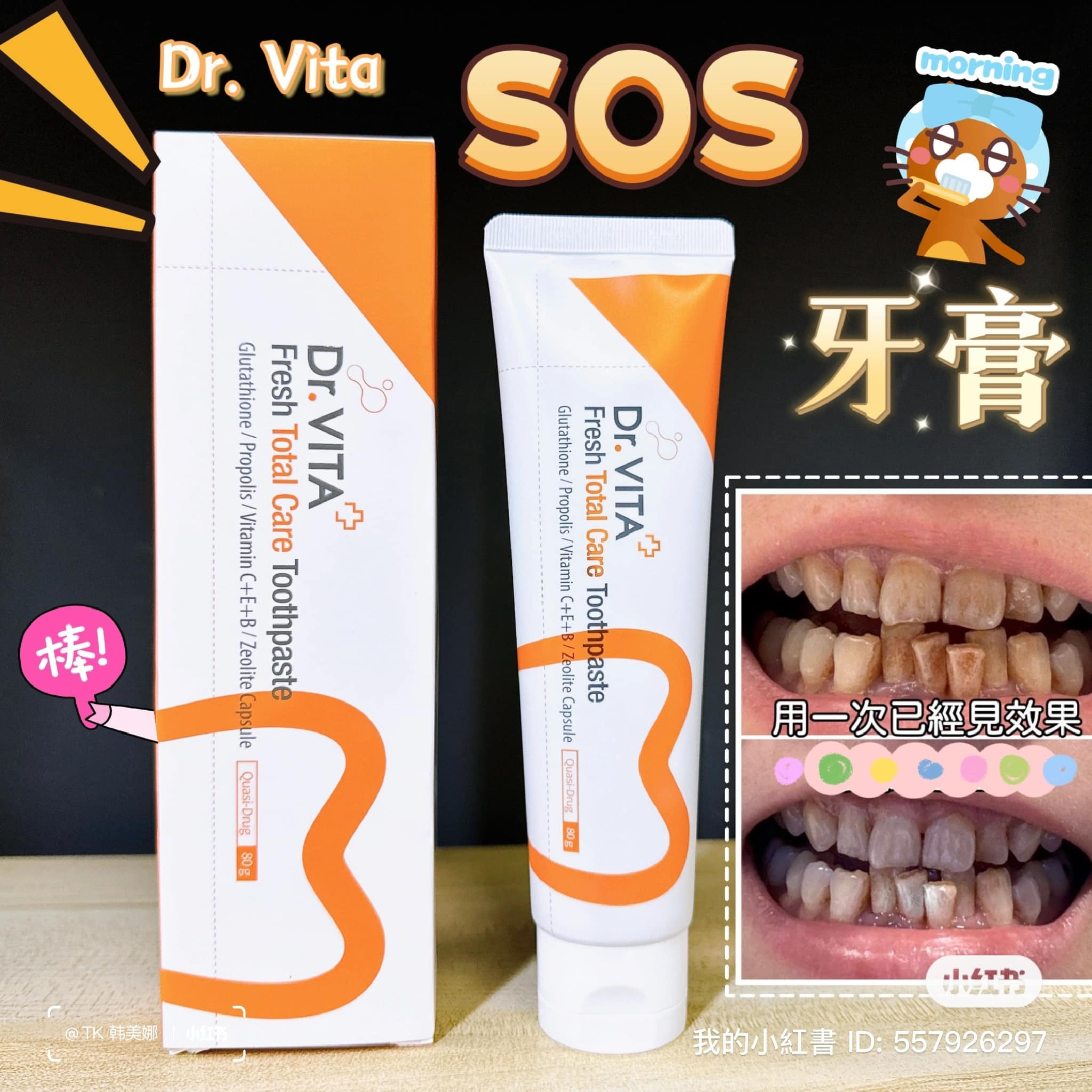 【直播】Dr.Vita LL102803 美白維他命SOS牙膏