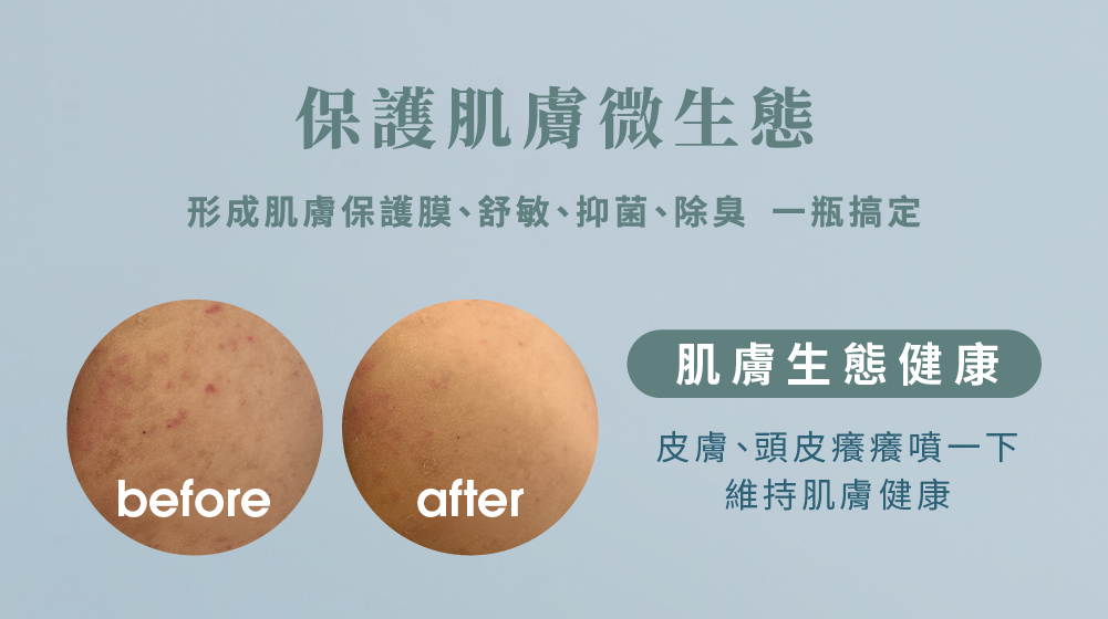 修護肌膚維持肌膚健康緩解異味性皮膚搔癢