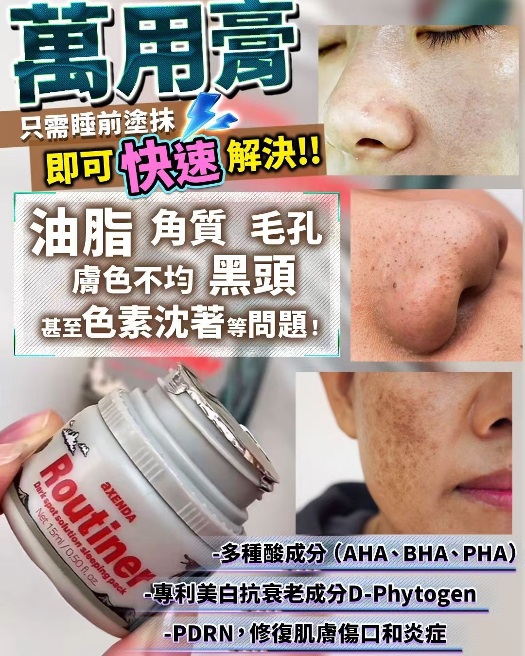 韓國VQM Axenda Routiner 去斑萬用膏15g Z269(三至四星期寄出)