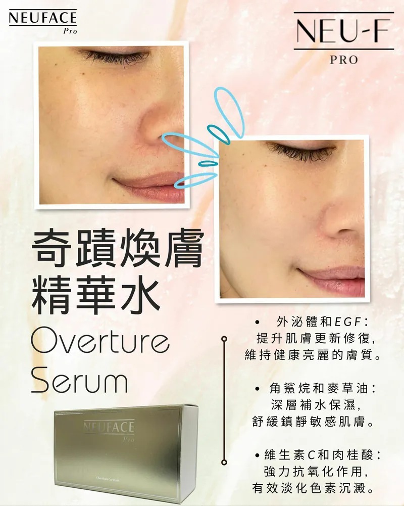 (4957) Neuface Pro  Overture Serum 【買1送1】