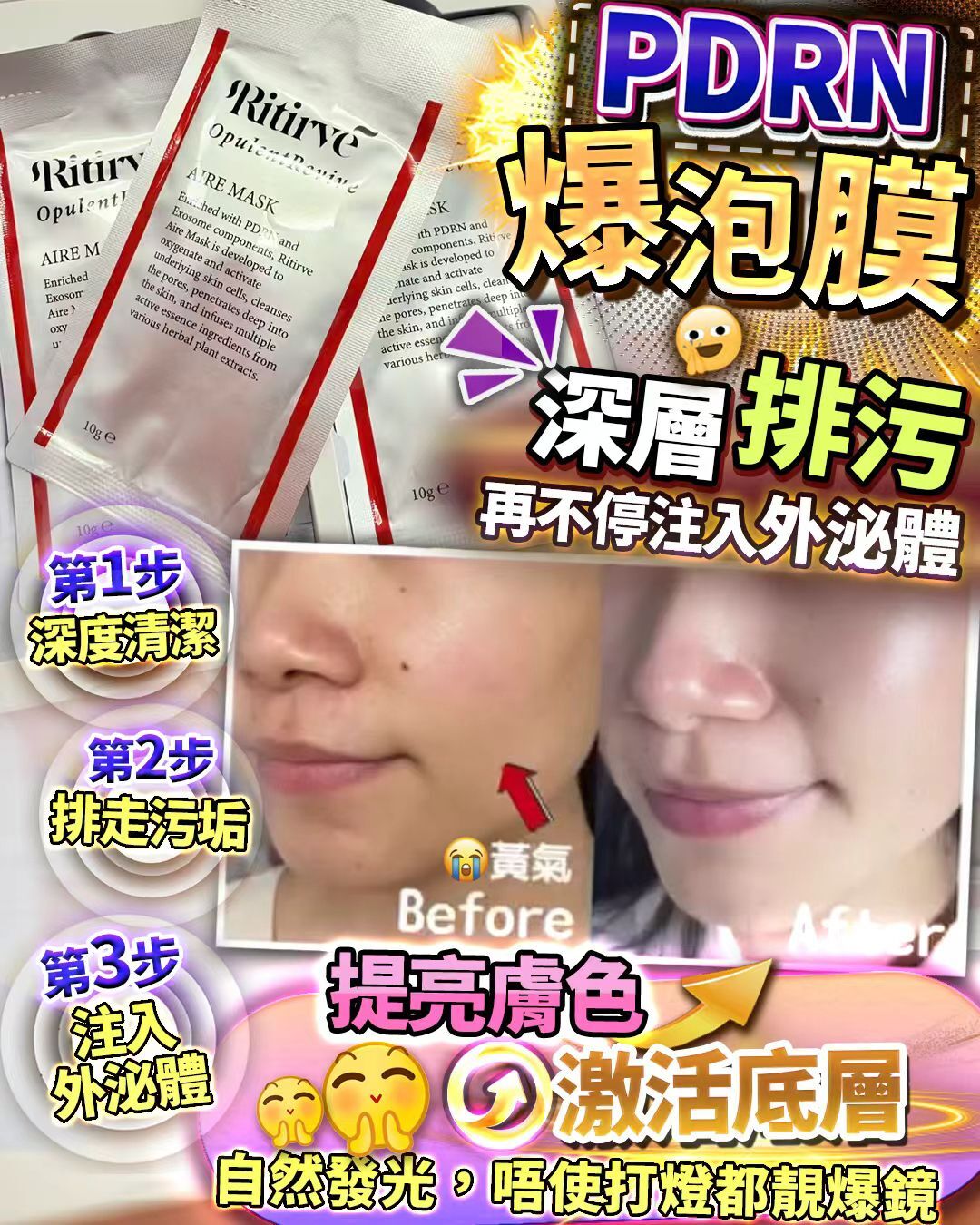 Ritirve PDRN Aire Mask 爆泡泡面膜 10包x10克 Z484（2-3 星期寄出）