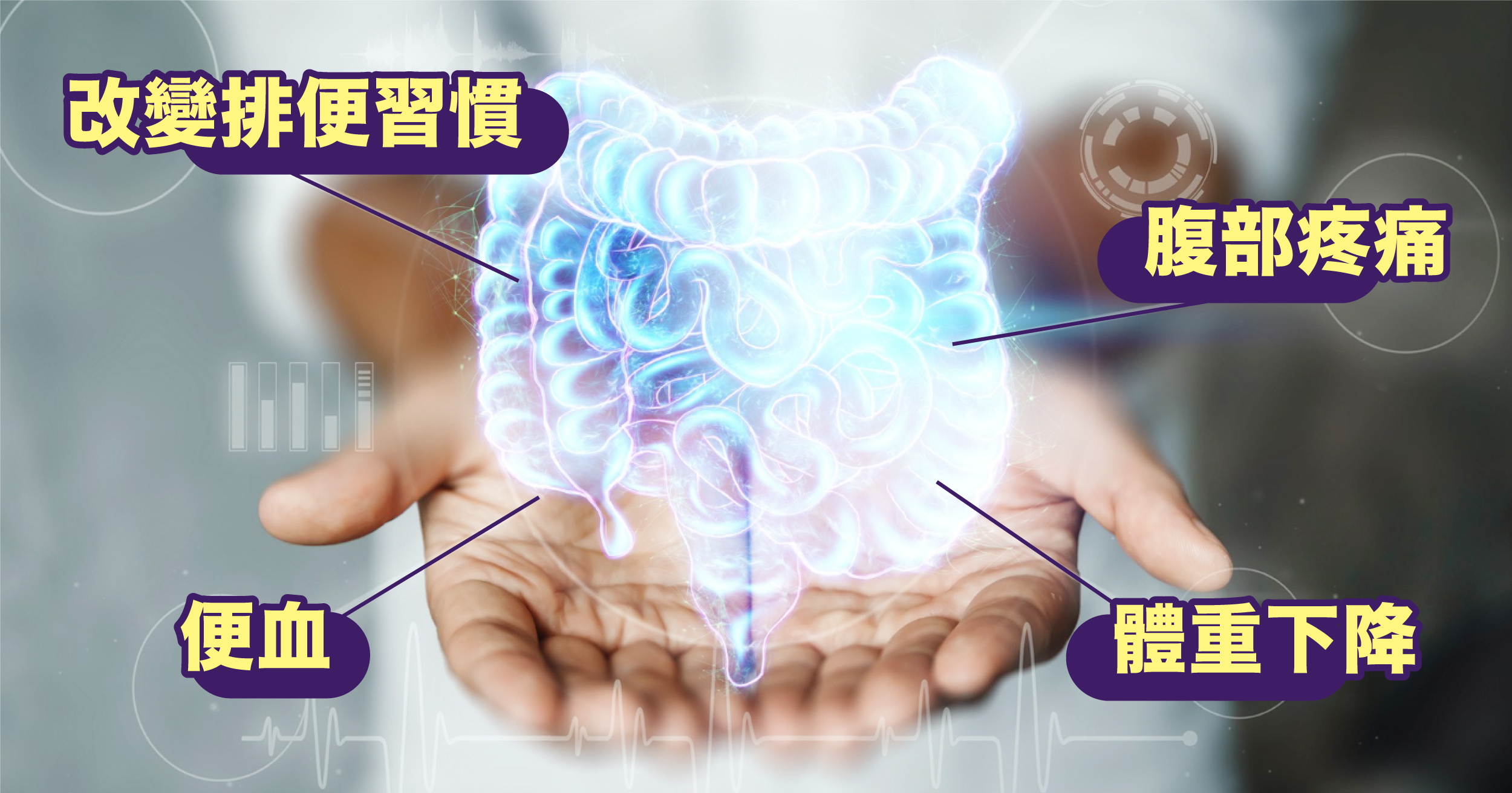 大腸頑典型的症狀包括排便習慣的改變、腹部疼痛、便血及體重下降等