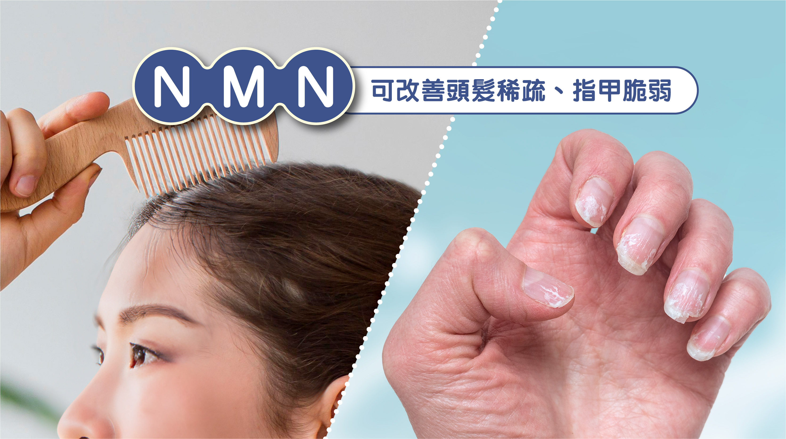 🍃由內而外的美麗：NMN 口服補充劑    唔單止外用，口服 NMN 補充劑可以從內部改善皮膚營養供應同代謝功能，增強肌膚自我修復能力，令皮膚更緊緻、更年輕。仲可以改善其他美容問題，例如頭髮稀疏、指甲脆弱等，全面提升整體外貌。