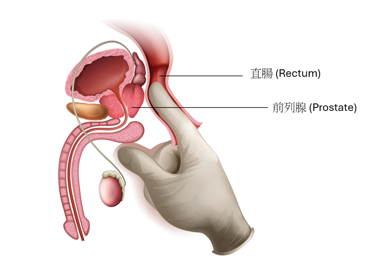 前列腺位置-前列腺高潮-前列腺按摩