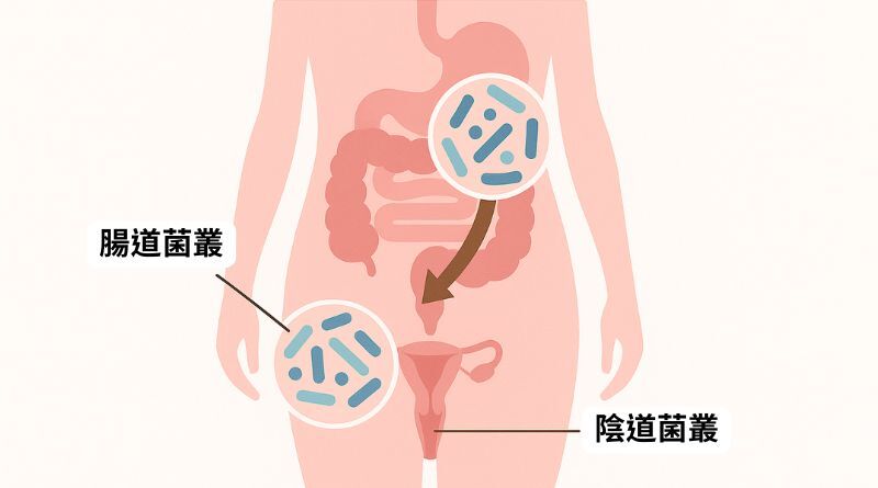 腸道與私密處連動示意圖 腸道菌叢與陰道菌叢的關聯示意,益生菌從內調節女性健康