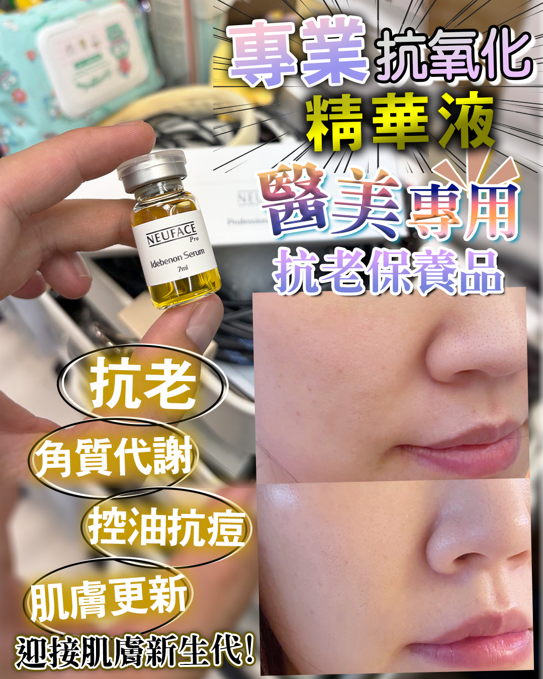 Neuface pro Professional Use Only Idebenon Serum 送 Neuface Pro Gift Mask 3片