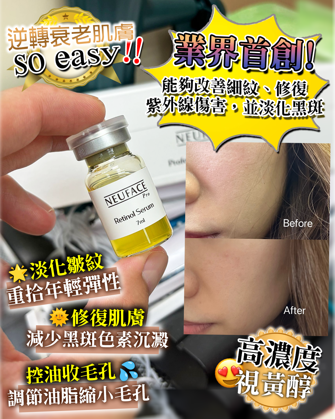 Neuface pro Professional Use Only Retinol Serum 送 Neuface Pro Gift Mask 3片