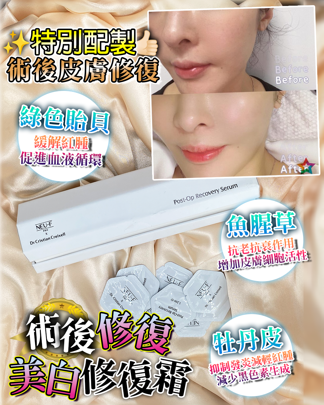 Neu-F X Dr. Cristian Creixell Post-Op Recovery Serum  送 Random Mask 12片