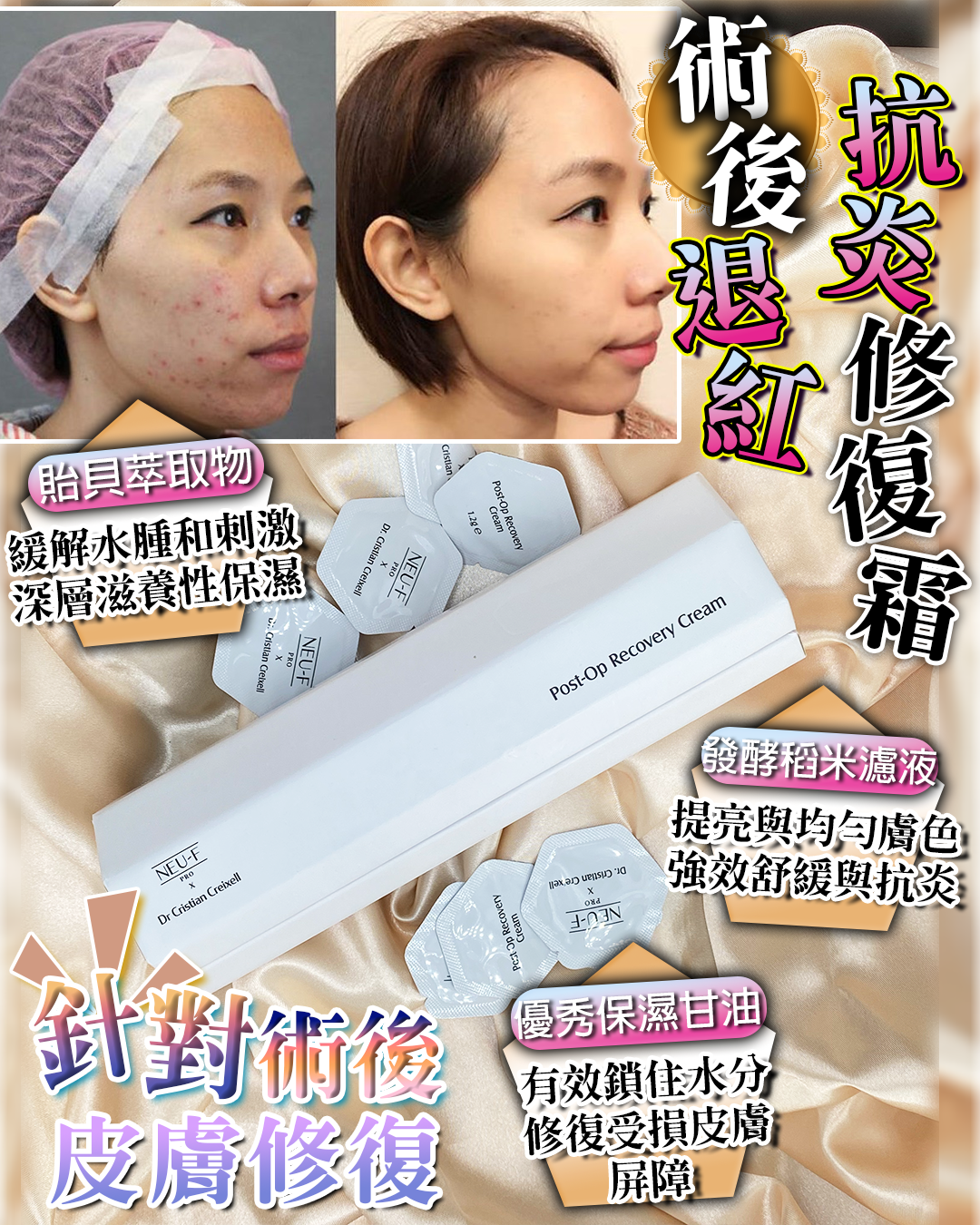 Neu-F X Dr. Cristian Creixell Post-Op Recovery Cream 送 Random Mask 12片