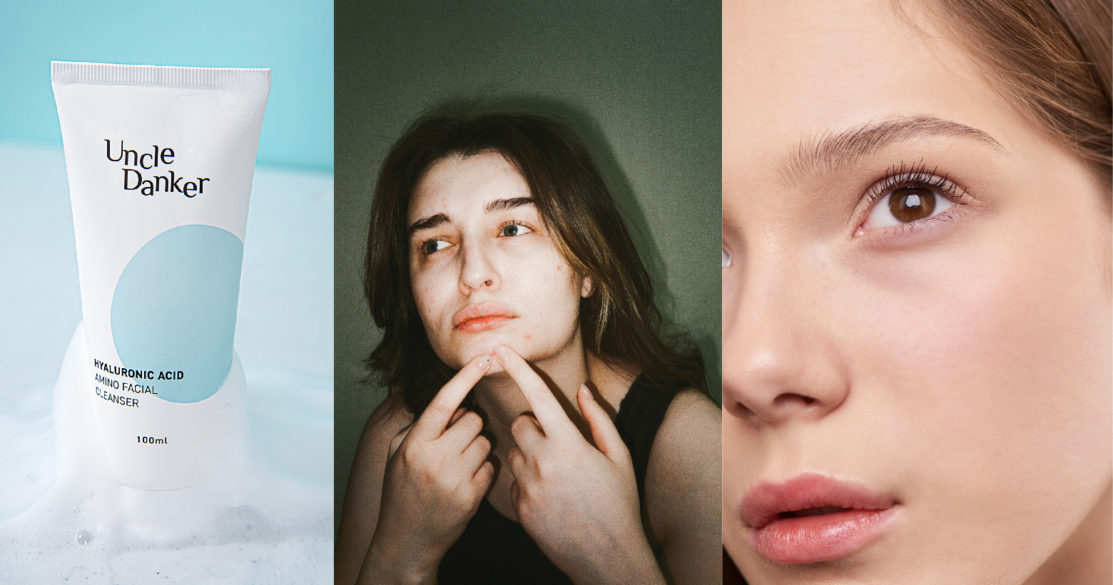 生理痘怎麼辦？經期3階段荷爾蒙變化與保養對策！胺基酸洗面乳推薦