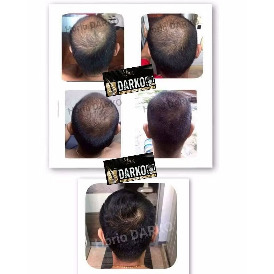 泰國直送 Horio Darko 防脫髮生髮 Supplements