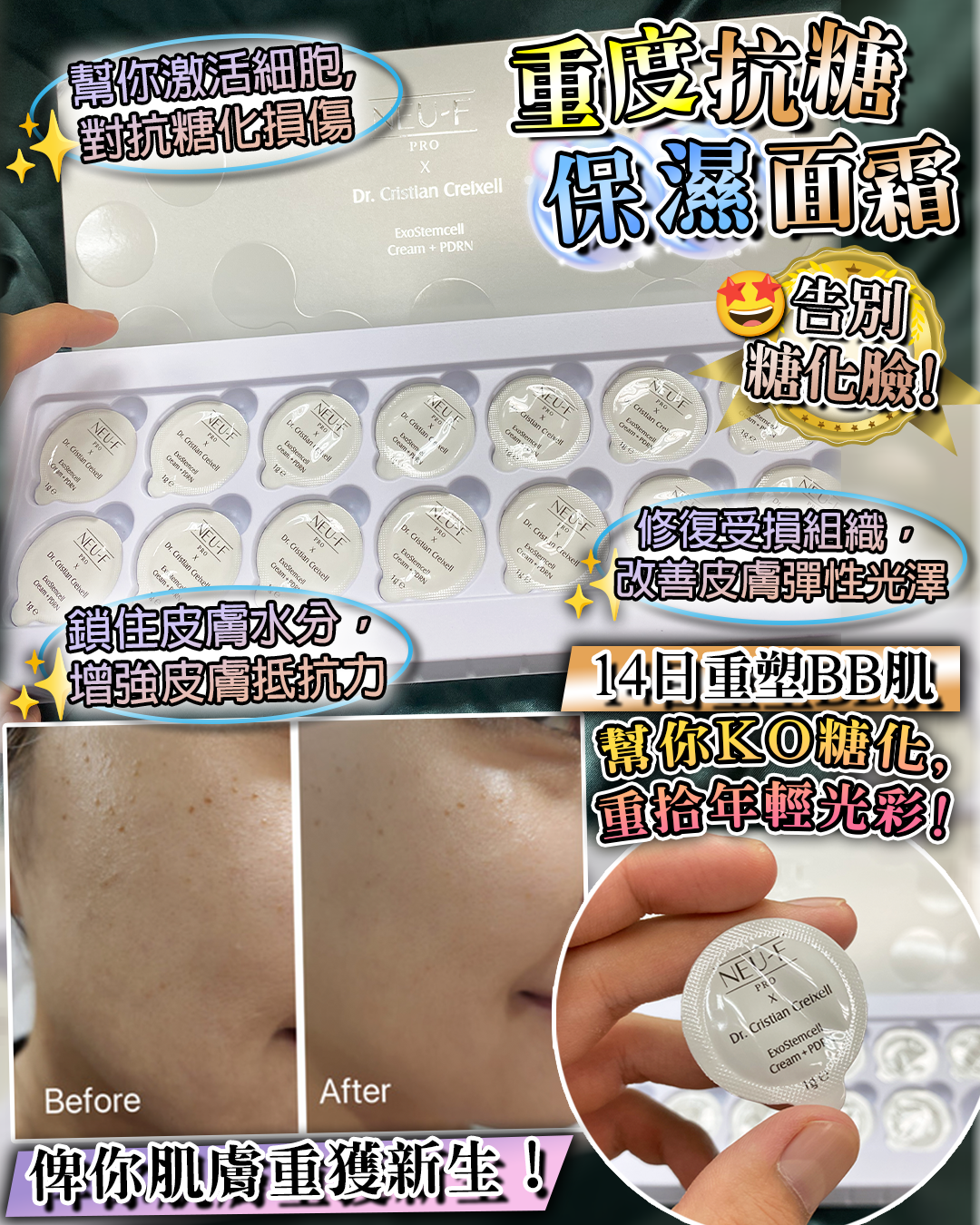 Neu-F X Dr. Cristian Creixell ExoStemcell + PDRN Cream  強效抗糖保濕面霜 1g x 14