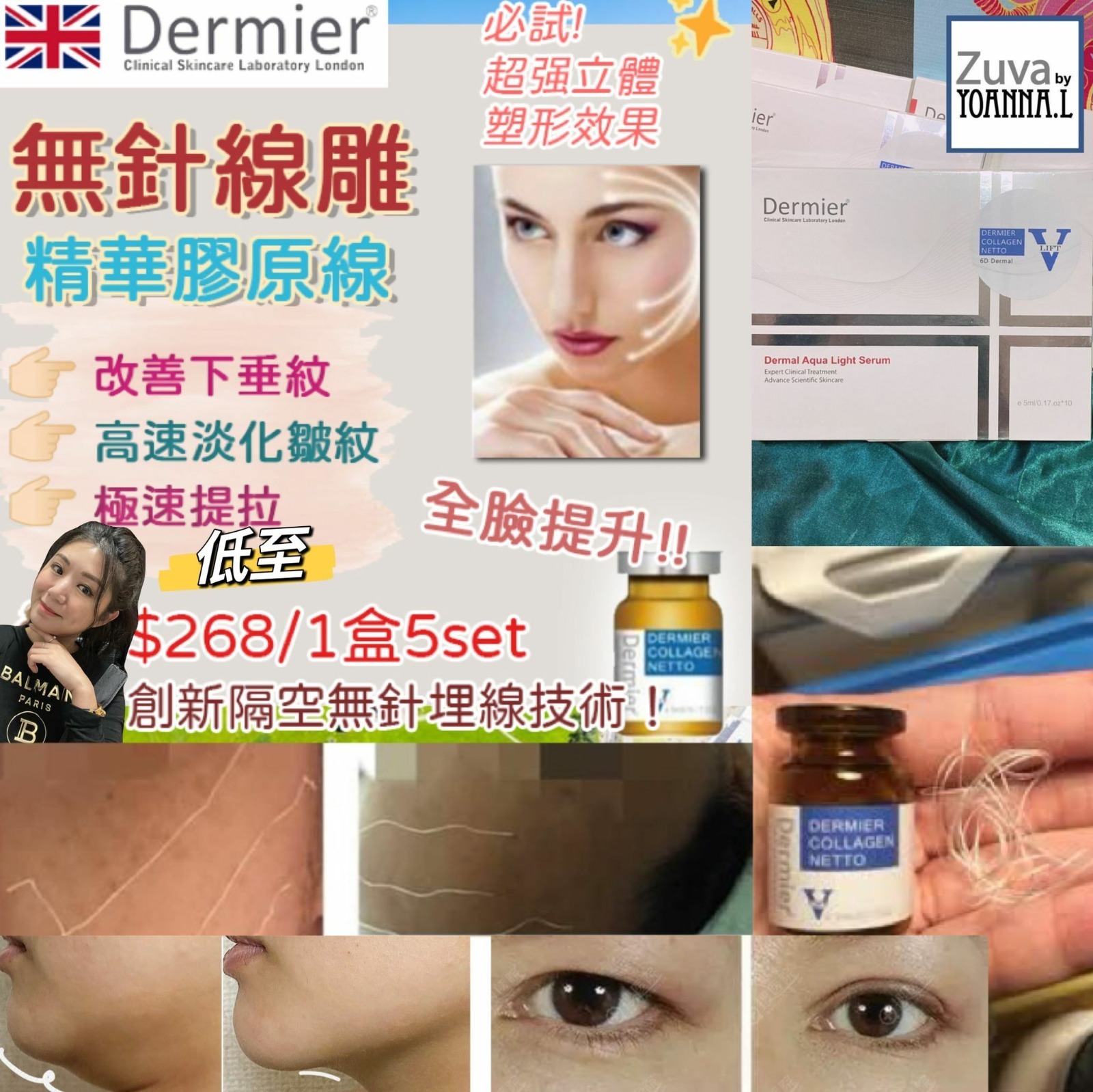 英國🇬🇧 Dermier 6D V Lift無針埋線療程(藍色原線)  Z555