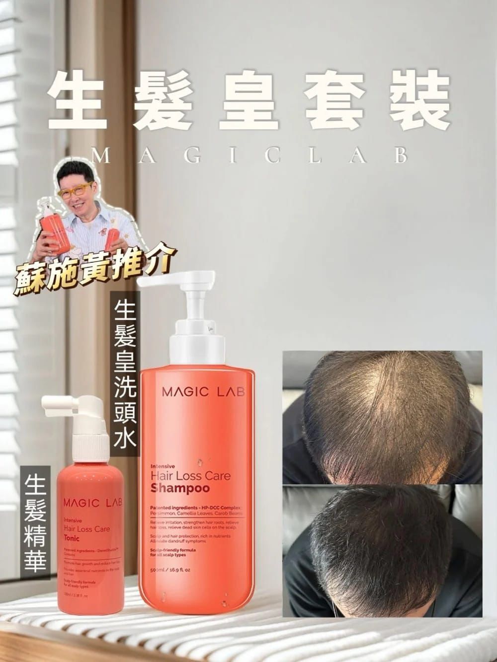 Magic Lab 勁生頭髮組合😍［生髮皇+生髮精華］[#SQ25111101]