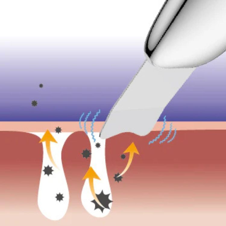 TOUCHbeauty GLOW超聲淨膚儀 Ultrasonic Scrub Device