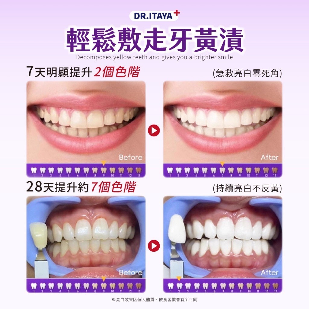 DR.ITAYA®️瑞士專研紫光炫白牙貼
