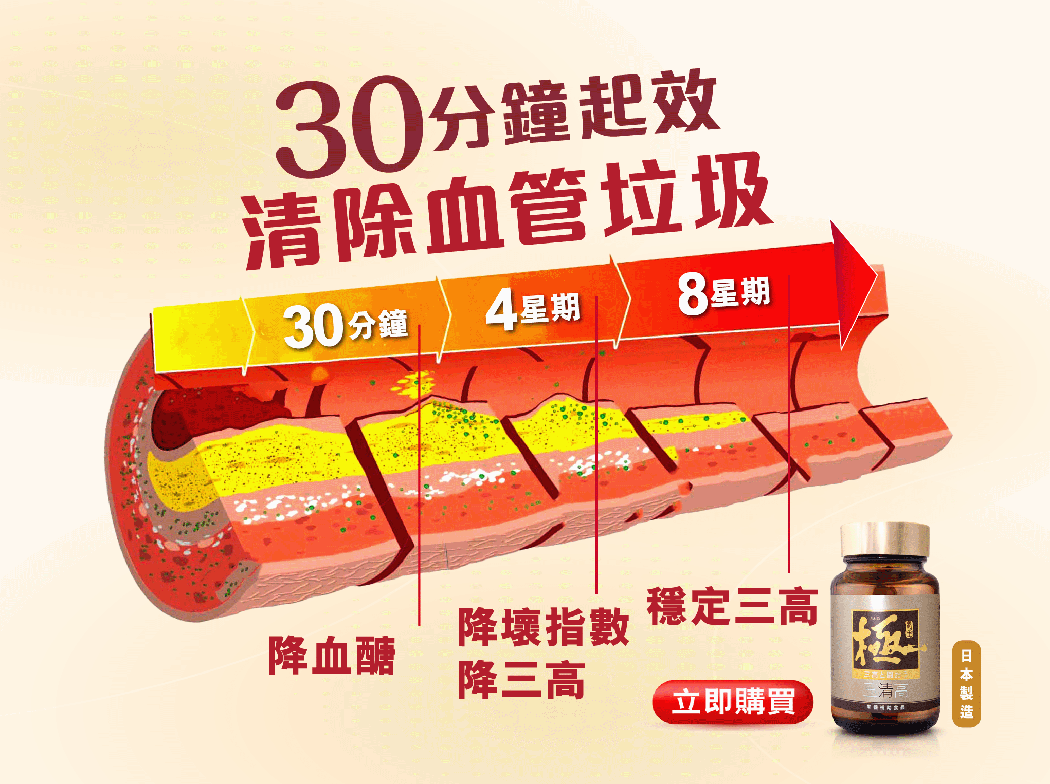 服食「極‧三清高」 由日本大學共同研發¹「極‧三清高」,五重截擊天然逆轉三高。最快30分鐘清除血管垃圾1,日本專利大麥發酵GABA*,或有助4星期穩定血壓3,8星期穩定三高指數。日本科研DNJ桑葉提取物,含活性成分亞氨基糖DNJ,能抑制餐後吸收,血醣降達41%1。日本野梧桐葉,有助抑制中性脂肪,減少內臟脂肪達33%2及減少肥胖問題。